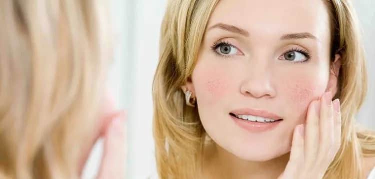 Najlepszy kolor włosów do cery naczynkowej: ukryj zaczerwienienia