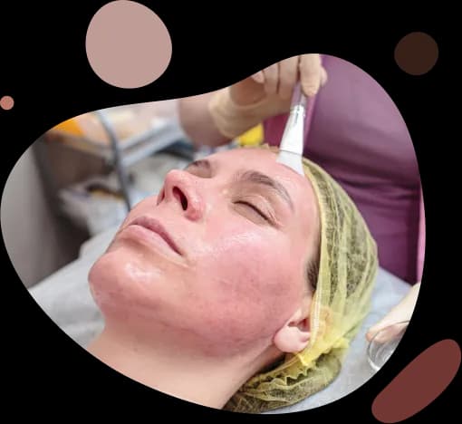 Cera naczynkowa: Skuteczne metody leczenia i pielęgnacji | Przewodnik