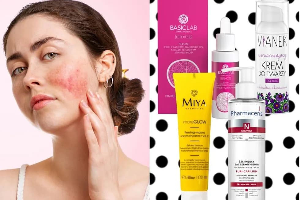 Najlepsze oleje do cery naczynkowej: ranking i skuteczne metody