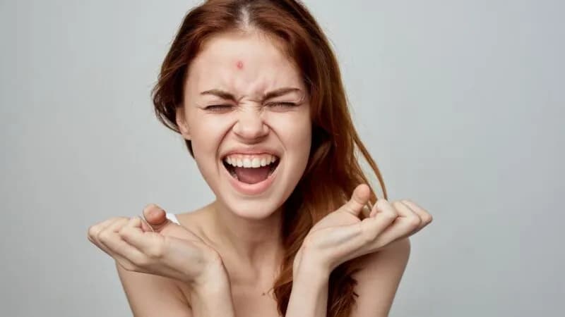 Jak szybko usunąć pryszcz? Sprawdzone metody na noc i ukrycie