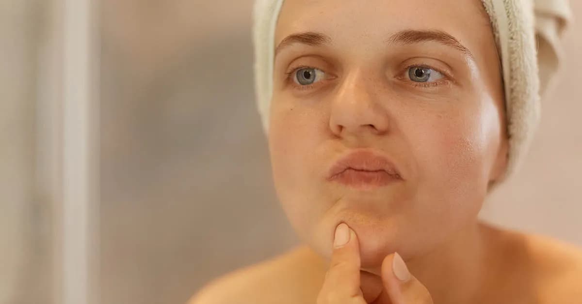 Jak pozbyć się podskórnego pryszcza? Domowe sposoby i porady